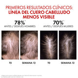 Dercos Aminexil Clinical R.E.G.E.N. Booster Sérum 90ml — Aminexil 1,5% y jengibre caída capilar