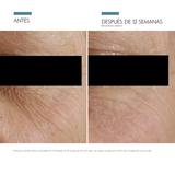 Comprar-0635494358209-SkinCeuticals-A.G.E.-Eye-Complex-15g-Tratamiento-Contorno-de-ojos-antiedad-en-farmacia-avenida-america