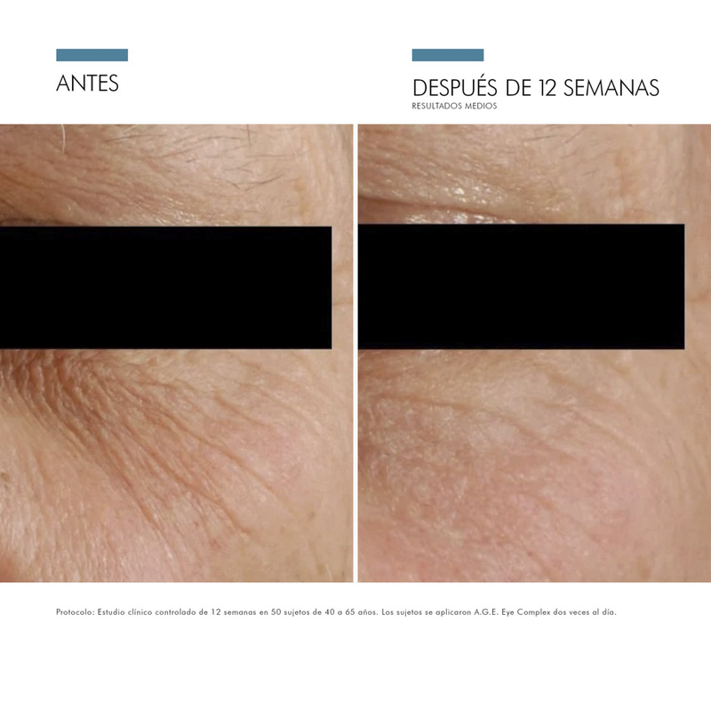 Comprar-0635494358209-SkinCeuticals-A.G.E.-Eye-Complex-15g-Tratamiento-Contorno-de-ojos-antiedad-en-farmacia-avenida-america