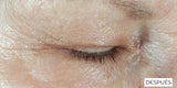 RoC Hydrate + Plump Contorno de Ojos - antes y después