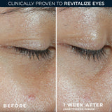 RoC Multi Correxion Revive + Glow Eye Balm antes y después