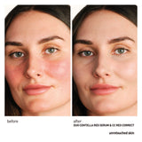 Centella Red Serum 30mL de Erborian