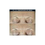Derm Correxion Serum Fill & Treat 15mL de RoC