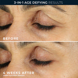 Retinol Correxion Line Smoothing Crema de Ojos 15mL de RoC