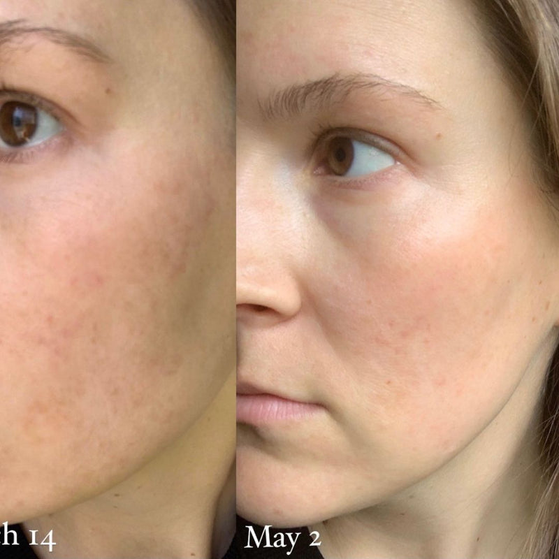 Holifrog Sunnyside C Glow Serum-comprar barato-Farmacia Avenida de America